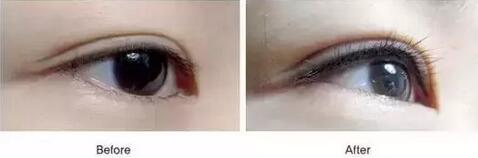 美瞳线和普通眼线有什么区别