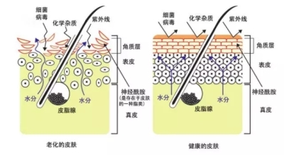 毛孔粗大和黑头形成的原因-如何去除