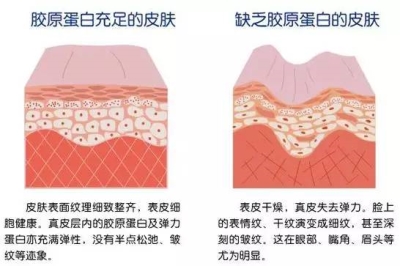 如何拯救“饥渴的肌肤”-艺星水光补水