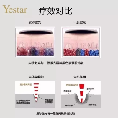 皮秒祛斑 VS 传统祛斑