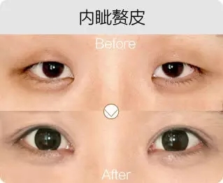 艺星艺星艺星艺星艺星艺星艺星艺星艺星艺星艺星艺星艺星艺星艺星艺星艺星艺星艺星艺星艺星艺星艺星艺星艺星艺星艺星艺星艺星艺星艺星艺星艺星美杜莎综合美眼前后对比图